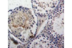 Used in DAB staining on fromalin fixed paraffin-embedded testis tissue (LGALS8 抗体  (AA 1-316))