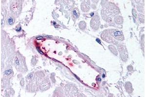 Human Vascular Endothelium (formalin-fixed, paraffin-embedded) stained with HUNK antibody ABIN213526 at 20 ug/ml followed by biotinylated goat anti-rabbit IgG secondary antibody ABIN481713, alkaline phosphatase-streptavidin and chromogen. (HUNK 抗体  (C-Term))