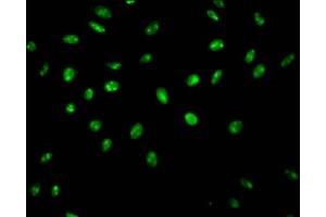 Immunofluorescence staining of Hela Cells with ABIN7127546 at 1:50, counter-stained with DAPI.