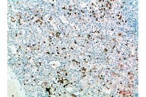 Immunohistochemistry (IHC) image for anti-Interleukin 31 (IL31) (AA 21-70) antibody (ABIN7189464)