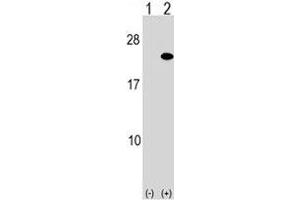 Western blot analysis of ARF5 antibody and 293 cell lysate either nontransfected (Lane 1) or transiently transfected (2) with the ARF5 gene. (ARF5 抗体  (AA 80-108))