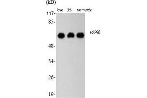 Western Blot analysis of various cells using HSP60 Polyclonal Antibody diluted at 1:2000.