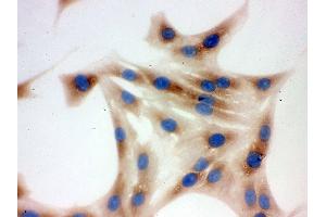 Immunohistochemistry (IHC) image for anti-Chaperonin Containing TCP1, Subunit 4 (Delta) (CCT4) (AA 452-539) antibody (ABIN4886514)