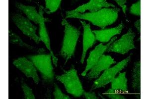 Immunofluorescence of monoclonal antibody to MGAT4B on HeLa cell. (MGAT4B 抗体  (AA 401-500))