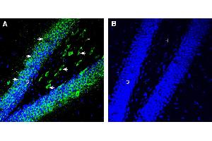 Expression of 5HT6 in mouse hippocampus.
