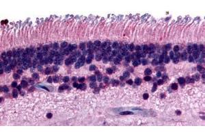 Immunohistochemistry (IHC) image for anti-Protein Tyrosine Phosphatase, Receptor Type, M (PTPRM) (Internal Region) antibody (ABIN1049277)