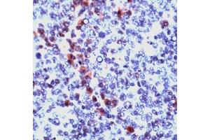 Image no. 1 for anti-Granzyme B (GZMB) (N-Term) antibody (ABIN372968) (GZMB 抗体  (N-Term))