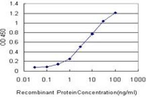 Detection limit for recombinant GST tagged TOM1 is approximately 0. (TOM1 抗体  (AA 394-491))