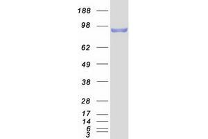 Western Blotting (WB) image for Catenin (Cadherin-Associated Protein), beta 1, 88kDa (CTNNB1) protein (Myc-DYKDDDDK Tag) (ABIN2713219)
