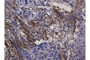 Immunohistochemistry (IHC) image for anti-Sterol O-Acyltransferase 2 (SOAT2) (AA 1-120) antibody (ABIN1490565) (SOAT2 抗体  (AA 1-120))