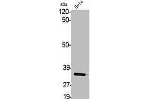Western Blot analysis of HELA cells using Aldose Reductase Polyclonal Antibody (AKR1B1 抗体  (C-Term))