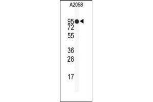 Image no. 1 for anti-Heat Shock Protein 90kDa alpha (Cytosolic), Class B Member 1 (HSP90AB1) (Middle Region) antibody (ABIN360230) (HSP90AB1 抗体  (Middle Region))