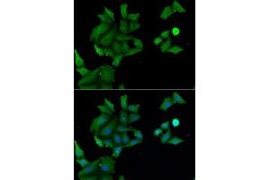 Immunofluorescence analysis of MCF7 cells using H antibody (ABIN6129030, ABIN6141583, ABIN6141584 and ABIN6222656). (HABP2 抗体  (AA 24-313))