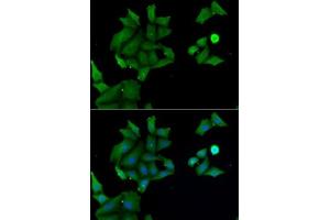 Immunofluorescence analysis of MCF7 cells using H antibody (ABIN6129030, ABIN6141583, ABIN6141584 and ABIN6222656). (HABP2 抗体  (AA 24-313))