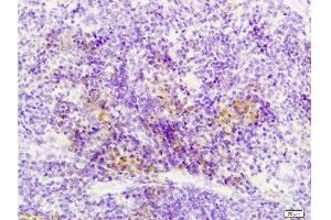 Immunohistochemistry (Paraffin-embedded Sections) (IHC (p)) image for anti-Sema Domain, Immunoglobulin Domain (Ig), Short Basic Domain, Secreted, (Semaphorin) 3F (SEMA3F) (AA 651-754) antibody (ABIN737976)