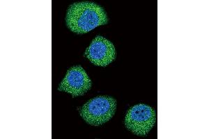 Confocal immunofluorescent analysis of FGFR2 Antibody (ABIN391968 and ABIN2841764) with  cell followed by Alexa Fluor 488-conjugated goat anti-rabbit lgG (green). (FGFR2 抗体)