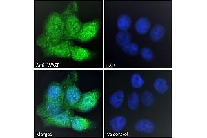 ABIN185368 Immunofluorescence analysis of paraformaldehyde fixed HepG2 cells, permeabilized with 0. (WASP 抗体  (Internal Region))