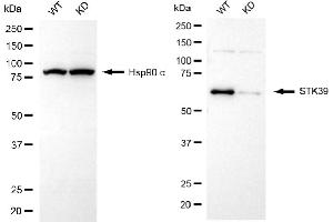 Western blotting analysis using STK39 antibody (ABIN7800304). (Recombinant STK39 抗体)