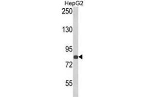 Western blot analysis of ECE1 Antibody (Center) in HepG2 cell line lysates (35ug/lane). (ECE1 抗体  (Middle Region))