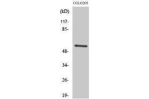 Western Blotting (WB) image for anti-IKAROS Family Zinc Finger 3 (Aiolos) (IKZF3) (Internal Region) antibody (ABIN3175609) (IKZF3 抗体  (Internal Region))