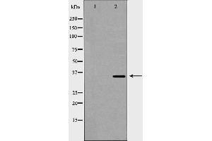 Western blot analysis of extracts of HeLa, using ANXA5 antibody. (Annexin V 抗体  (C-Term))