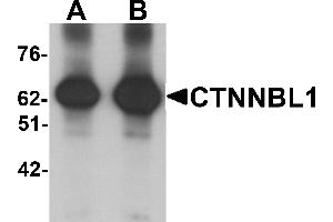 Western blot analysis of CTNNBL1 in human brain tissue lysate with CTNNBL1 antibody at (A) 1 and (B) 2 µg/mL. (CTNNBL1 抗体  (C-Term))