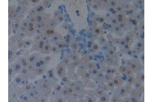 Detection of PDCD6IP in Mouse Liver Tissue using Polyclonal Antibody to Programmed Cell Death Protein 6 Interacting Protein (PDCD6IP) (ALIX 抗体  (AA 1-239))