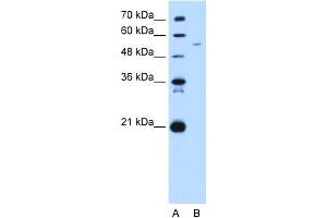 WB Suggested Anti-GAS7 Antibody Titration:  5. (GAS7 抗体  (C-Term))