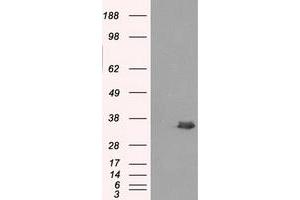 Image no. 1 for anti-Aldo-Keto Reductase Family 1, Member A1 (Aldehyde Reductase) (AKR1A1) antibody (ABIN1496547) (AKR1A1 抗体)