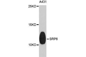 Western blot analysis of extracts of A431 cells, using SRP9 antibody. (SRP9 抗体)