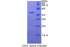 SDS-PAGE analysis of Human Periplakin Protein. (PPL 蛋白)