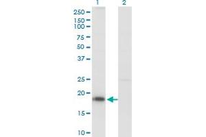 Western Blot analysis of KISS1 expression in transfected 293T cell line by KISS1 monoclonal antibody (M03), clone 1D11. (KISS1 抗体  (AA 46-145))