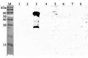 Western blot analysis using anti-ANGPTL3 (human), pAb  at 1:4'000 dilution. (ANGPTL3 抗体  (AA 194-213))