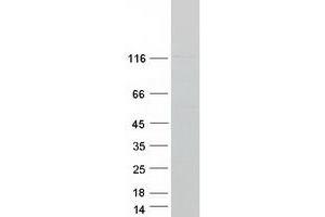 Western Blotting (WB) image for HAUS Augmin-Like Complex, Subunit 6 (HAUS6) protein (Myc-DYKDDDDK Tag) (ABIN2722445)