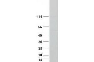 FAM29A Protein (Myc-DYKDDDDK Tag)