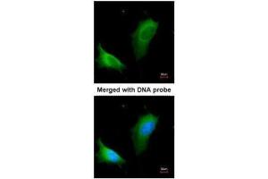 ICC/IF Image Immunofluorescence analysis of paraformaldehyde-fixed HeLa, using arginase I , antibody at 1:200 dilution. (Liver Arginase 抗体)