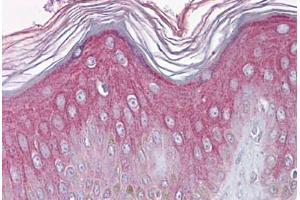 Human Skin: Formalin-Fixed, Paraffin-Embedded (FFPE) (FGFR1 抗体  (N-Term))