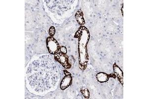 Immunohistochemical staining of human kidney with SLC17A2 polyclonal antibody  shows strong cytoplasmic and membranous positivity in cells in tubules at 1:50-1:200 dilution. (SLC17A2 抗体)
