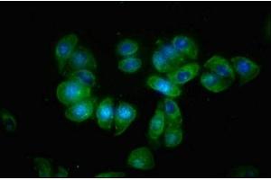 Immunofluorescence staining of HepG2 cells with ABIN7145515 at 1:66, counter-stained with DAPI. (Klotho beta 抗体  (AA 1-130))
