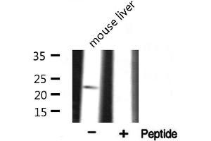 Western blot analysis on mouse liver lysate using RPS9 Antibody (RPS9 抗体  (Internal Region))