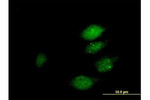 Immunofluorescence of purified MaxPab antibody to DUSP22 on HeLa cell. (DUSP22 抗体  (AA 1-184))