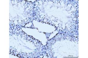 IHC analysis of MCM6 using anti-MCM6 antibody (ABIN7600037). (MCM6 抗体  (AA 14-821))