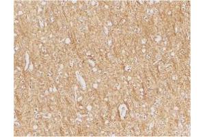 Image no. 1 for anti-anthrax Toxin Receptor 1 (ANTXR1) (Internal Region) antibody (ABIN205769) (ANTXR1 抗体  (Internal Region))