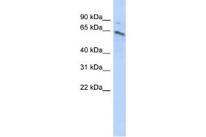 WB Suggested Anti-ZNF468 Antibody Titration:  0. (ZNF468 抗体  (Middle Region))