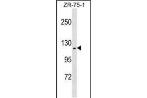 Western blot analysis in ZR-75-1 cell line lysates (35ug/lane). (ZHX2 抗体  (N-Term))