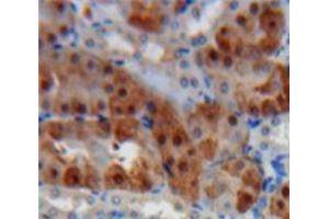 Used in DAB staining on fromalin fixed paraffin-embedded Kidney tissue (Cathepsin K 抗体  (AA 115-329))