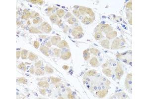 Immunohistochemistry of paraffin-embedded Human stomach using MSMB Polyclonal Antibody at dilution of 1:100 (40x lens). (MSMB 抗体)