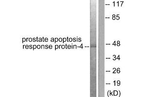 Western blot analysis of extracts from NIH/3T3 cells, using Prostate Apoptosis Response Protein-4 antibody (ABIN5976494). (PAWR 抗体  (C-Term))