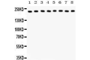 Anti- Integrin alpha 5 Picoband antibody, Western blotting All lanes: Anti Integrin alpha 5  at 0. (ITGA5 抗体  (AA 787-992))
