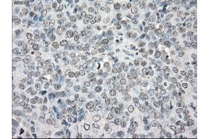 Image no. 6 for anti-Protein Phosphatase 5, Catalytic Subunit (PPP5C) antibody (ABIN1500389)